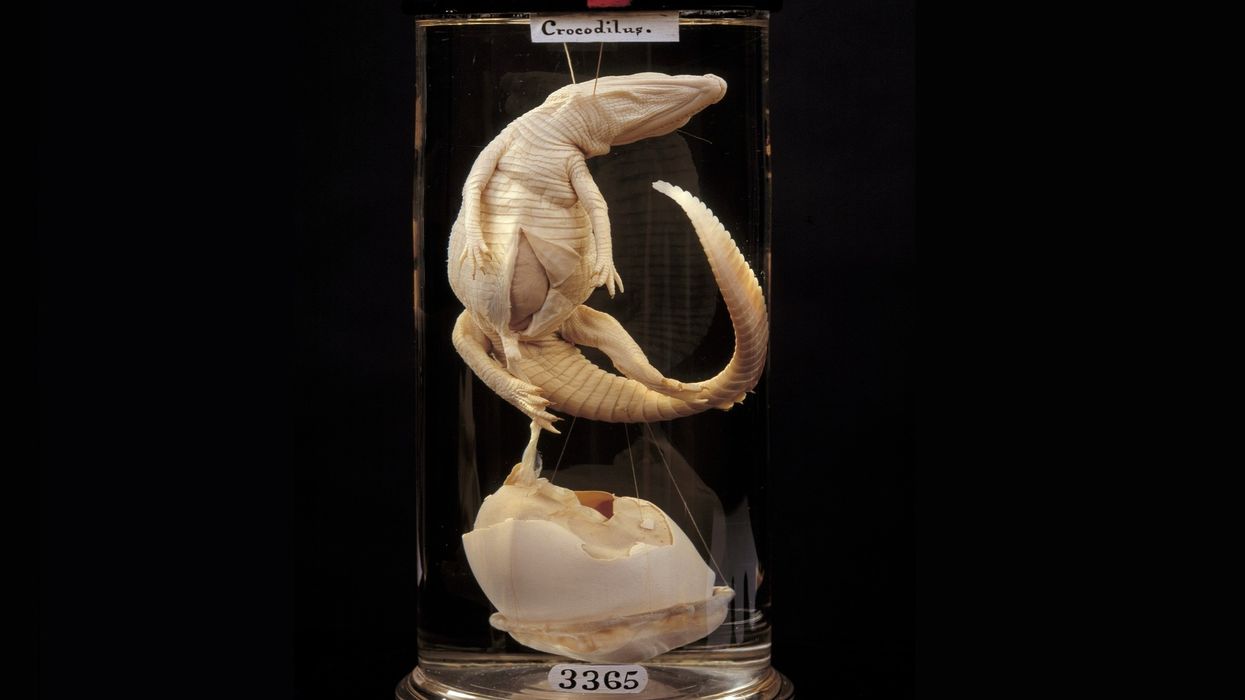 hunterian museum specimen