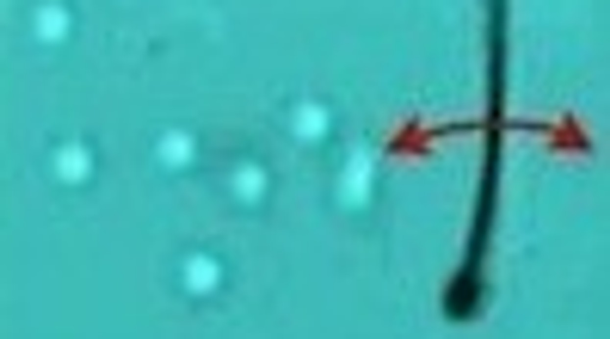 On Robotic Sperm and Shark Skin