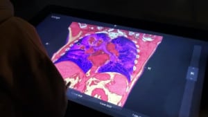 Interspectral Corona exhibit touch table and a 3d model of covid-19 infected lungs