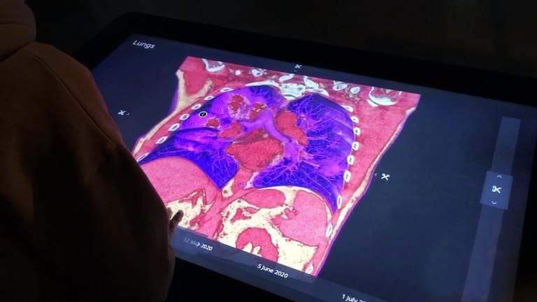 Interspectral Corona exhibit touch table and a 3d model of covid-19 infected lungs